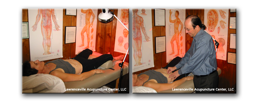 Acpuncture Session Photos